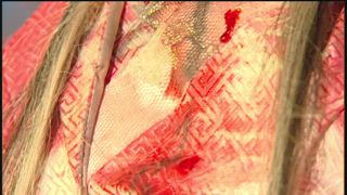 第24集
