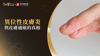 第20集 朱家瑜醫師｜越洗越癢？醫曝「過度清潔」竟是濕疹元兇！異位性皮膚炎不能吃海鮮？權威破解三大迷思