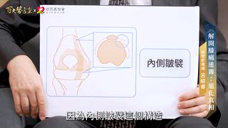 第44集(上) 呂紹睿醫師｜誤會一輩子！退化性關節炎跟「退化」毫無關係！「全台最難掛號的醫生」揭密：以前你的治療都錯了？