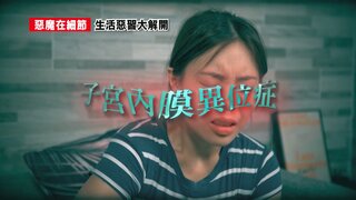 第10集 子宮內膜異位