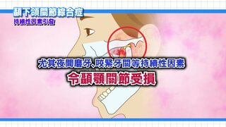 第6集 顳下頜關節綜合症