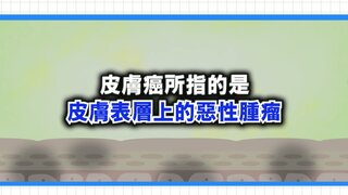 第8集 皮膚癌