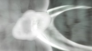 第52集